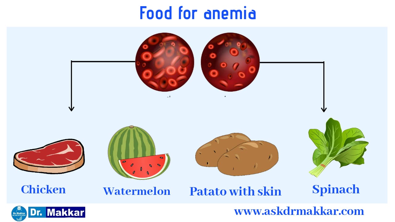 Anemia Homeopathic Treatment Dr Makkar India Punjab Mohali 2887